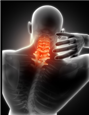 3-D image of the back view of a man, showing orange coloured cervical bones