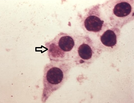 Photomicrograph of Chlamydia trachomatis