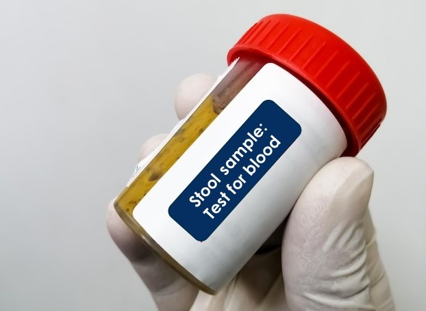 Container with stool sample for blood in stool test