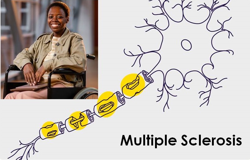 Smiley student in a wheel chair as a consequence of nerve damage from multiple sclerosis