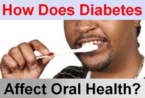 Diabetes and oral health