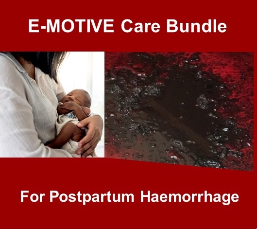 E-Motive bundle for PPH