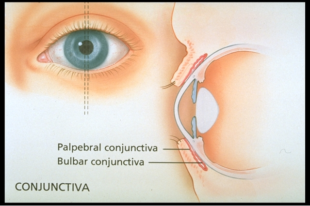 Eye showing location of the conjunctiva