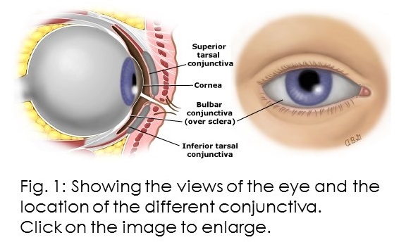 Image of views of the eye showing locations of different conjunctiva.