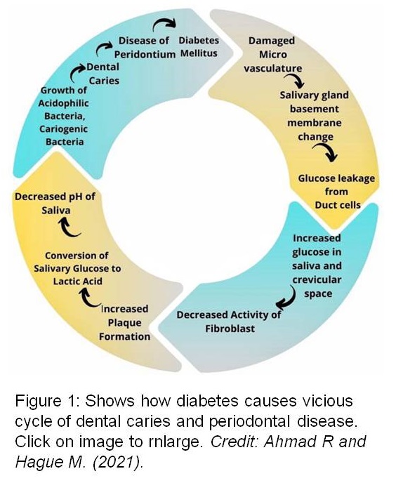 Figure1 showing vicious cycle of diabetes on dental caries and periodontal disease.