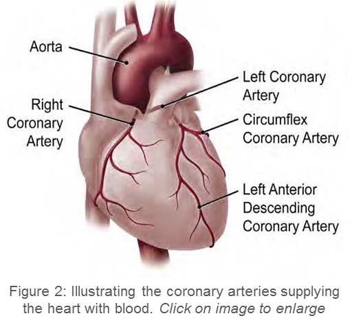 Illustration showing the coronary arteries supply blood to the heart.