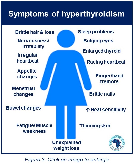 Symptoms of hyperthyroidism