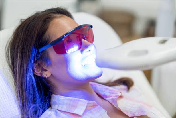 Whitening solutions with LED light activation.