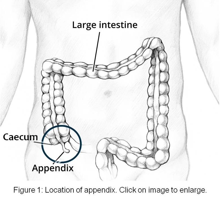 Image showing location of the appendix