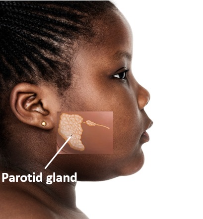 Close up view of the left side of the face of an African girl with an insert illustrating the location of the parotid gland