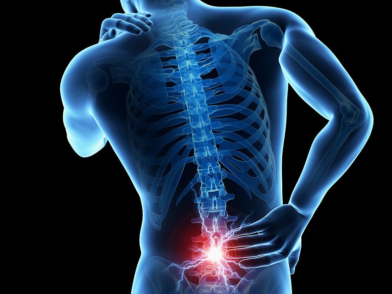 Illustration: Location of low back pain