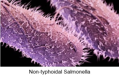 Microscopic image of non-typhoidal Salmonella