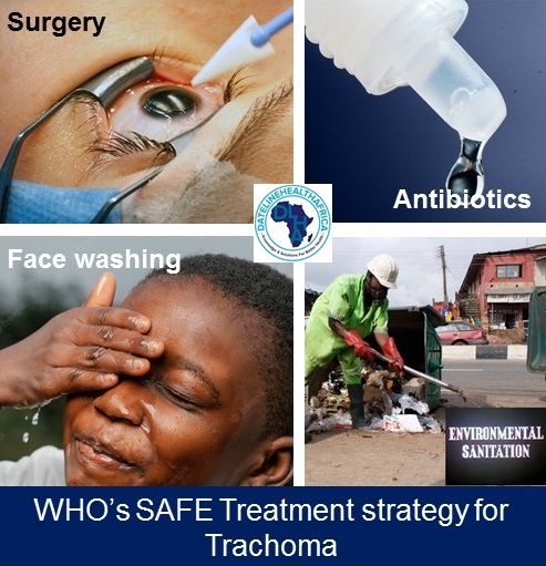 SAFE treatment strategy for trachoma