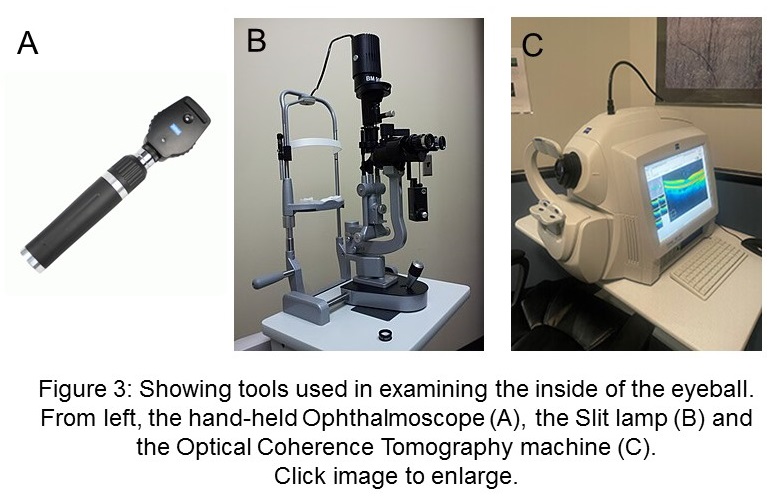 Tools for eye exam