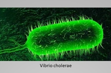 Microscopic image of Vibrio cholerae