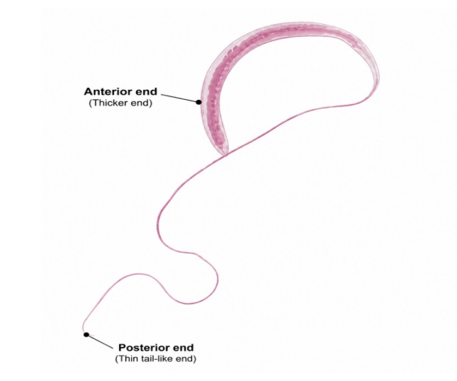 Image: Whipworm (TrichurisTrichiura)