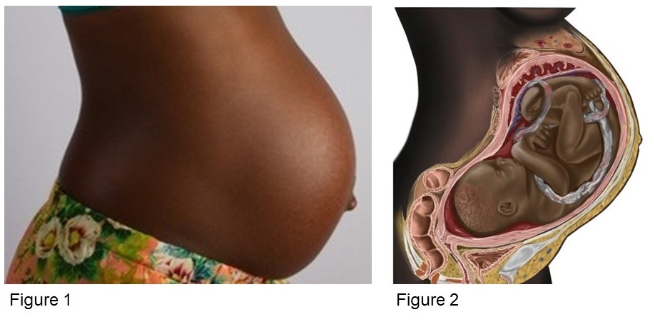 Composite image of black pregnant woman and depiction of baby in womb.