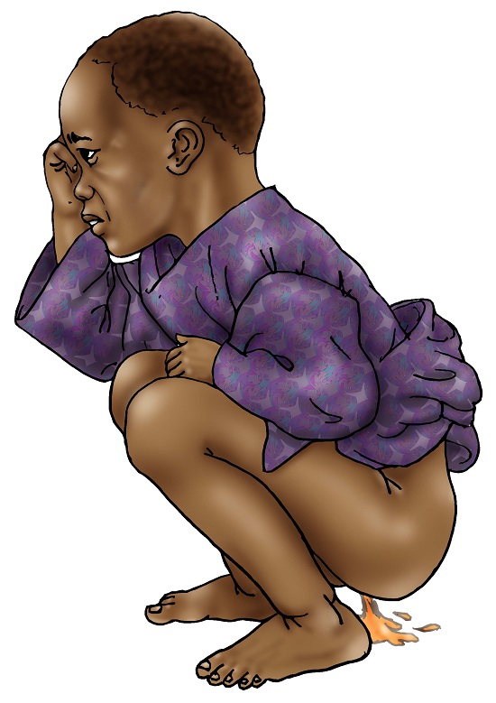 A squatting black child with diarrhoea