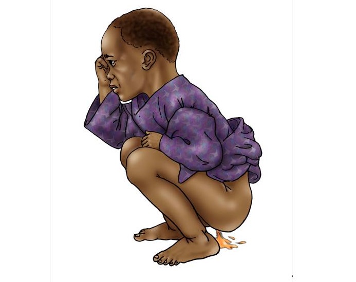 Black toddler with diarrhoea