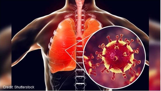 Cartoon image depicting the Coronavirus is association with the lungs