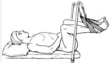 Illustration of dorsal lithotomy lie