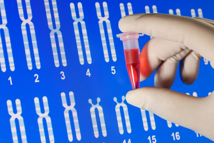 Chromosomes of the body and their evaluation