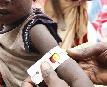 Afn African child standing and having his arm crcumference measured in effort to screen for malnutrition 