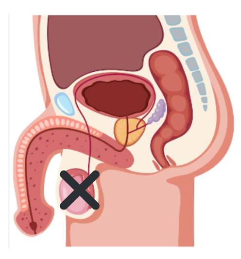 Diabetes can affect testicular structure and function