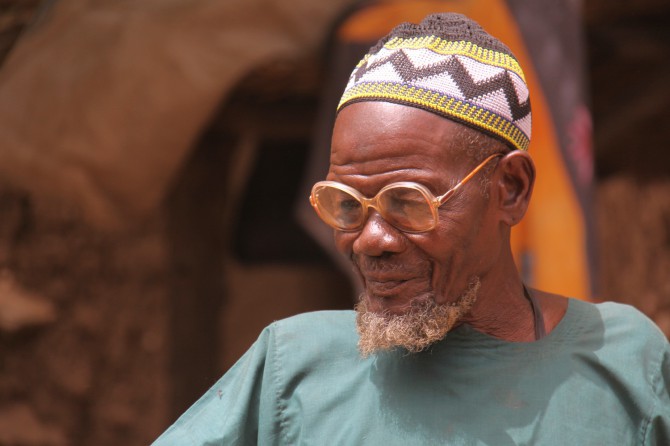 An elderly African man at risk for benign prostatic hyperplasia or enlargement