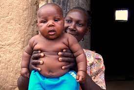 An African mother holding and showing off her overweight baby
