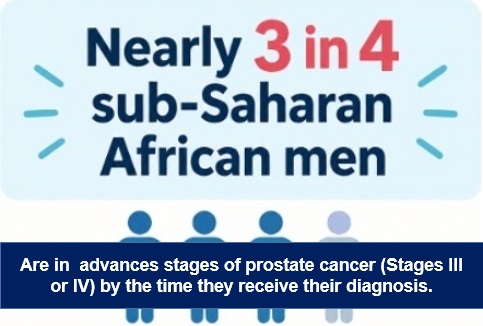 Infographic showing the rate of late stage diagnosis of prostate cancer in sub-Saharan Africa