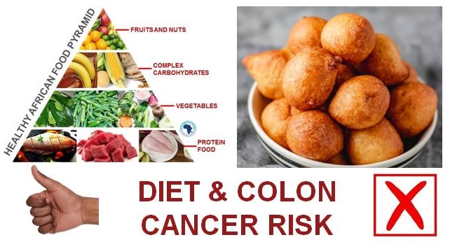Colon cancer risk. Healthy versus junk food